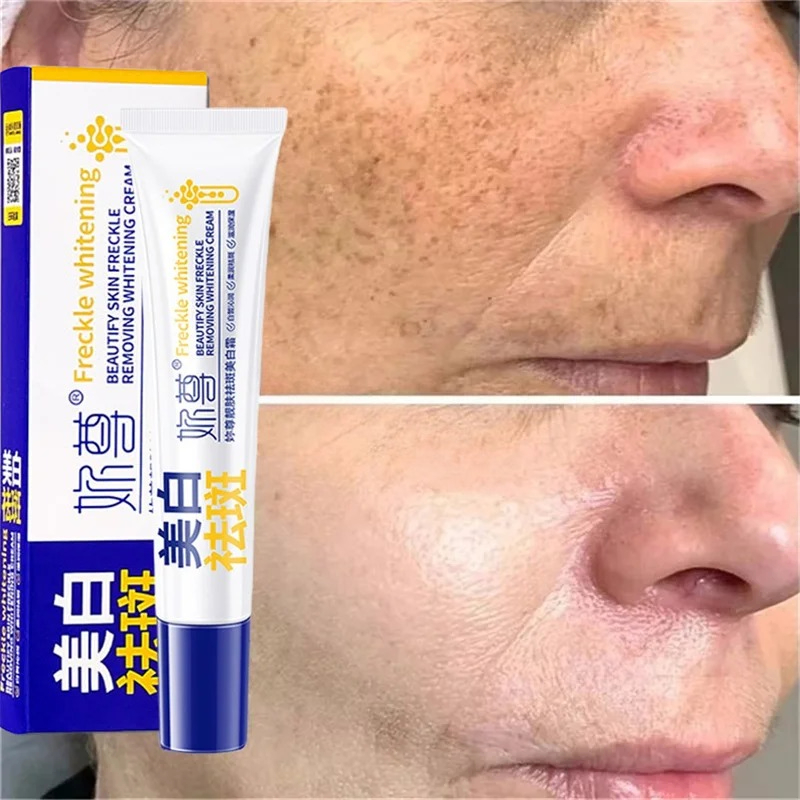 Powerful Spot-Removing Whiten  - огляд і ціна Skincare Korea
