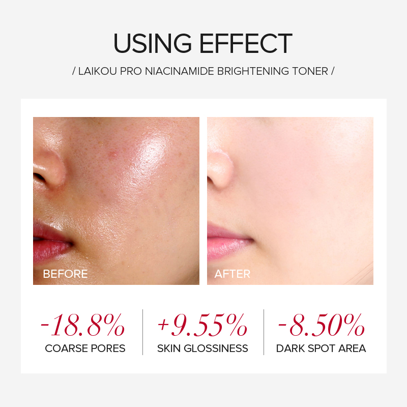 LAIKOU PRO Niacinamide 4Pcs Br - огляд і ціна Skincare Niacinamide