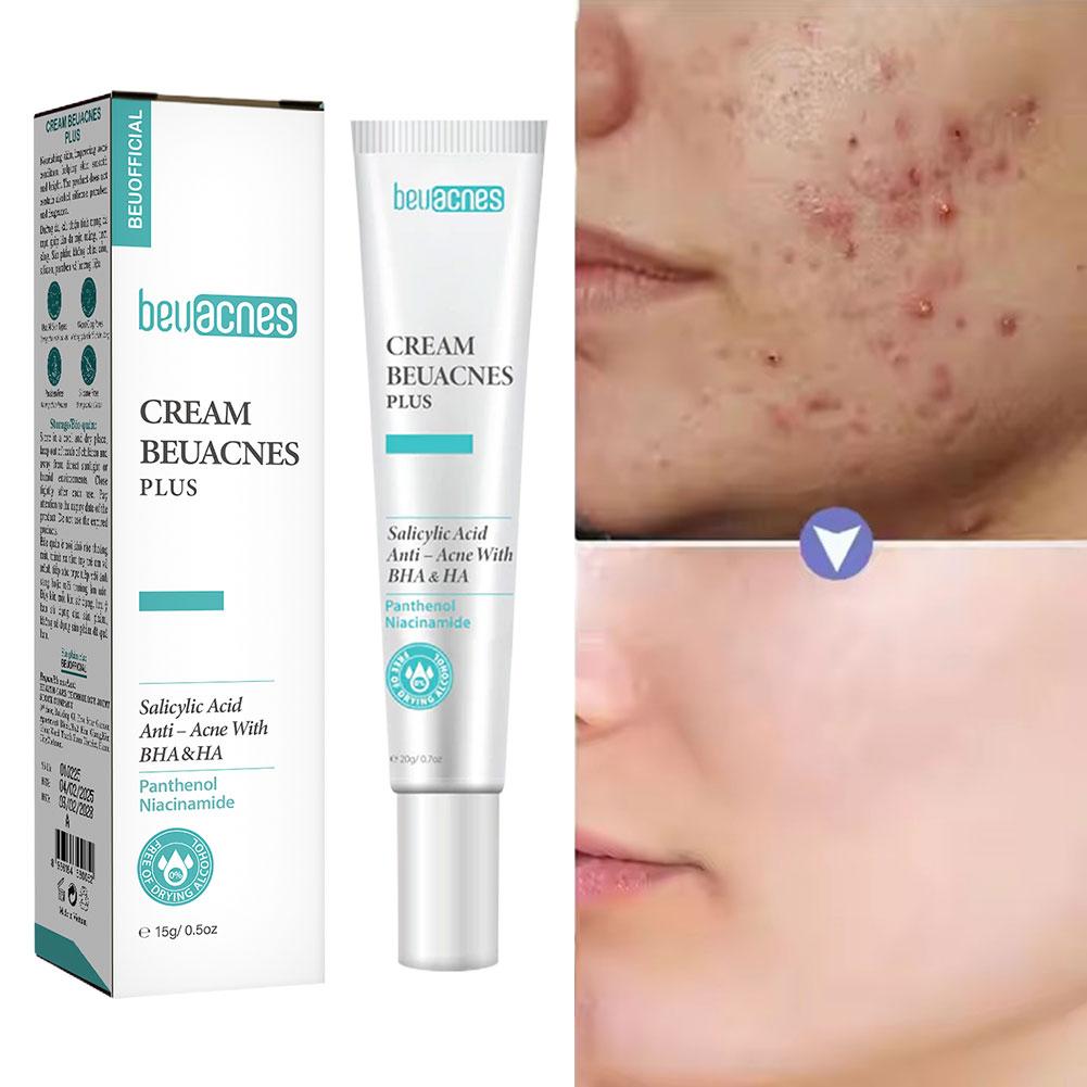 New 20g Niacinamide Acne Gel A - огляд і ціна Skincare Niacinamide