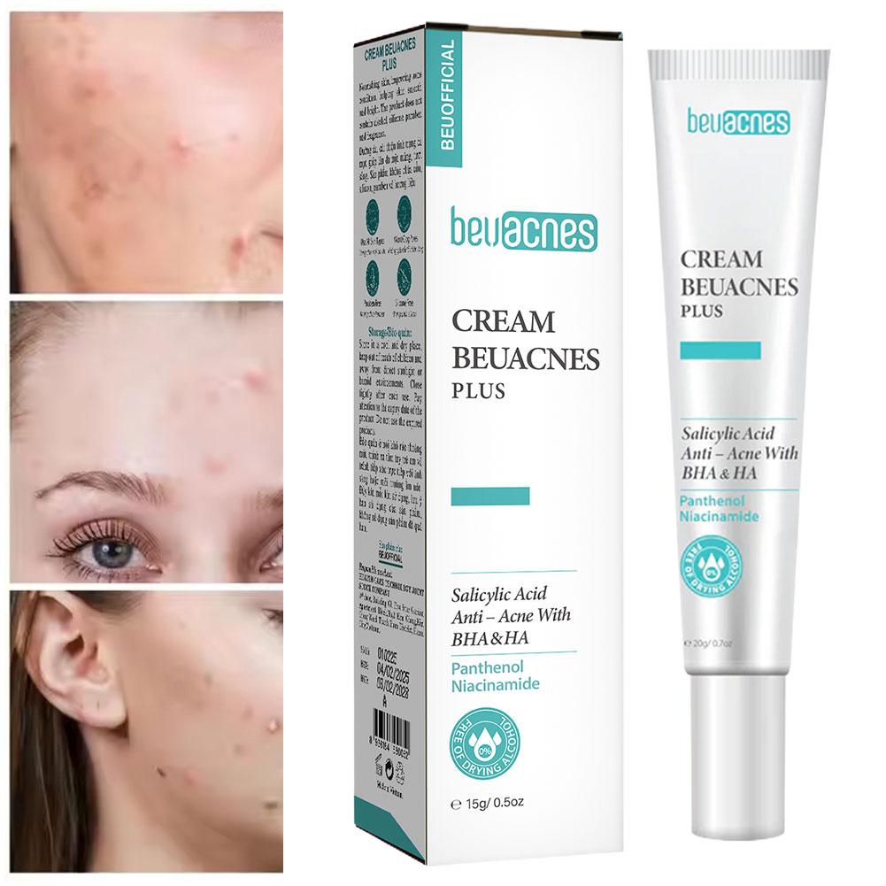 New 20g Niacinamide Acne Gel A - огляд і ціна Skincare Niacinamide