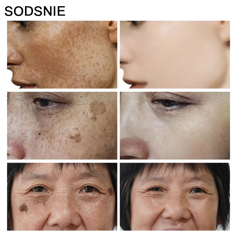 Dark Spot Remover Vitamin C Wh - огляд і ціна Skincare Niacinamide