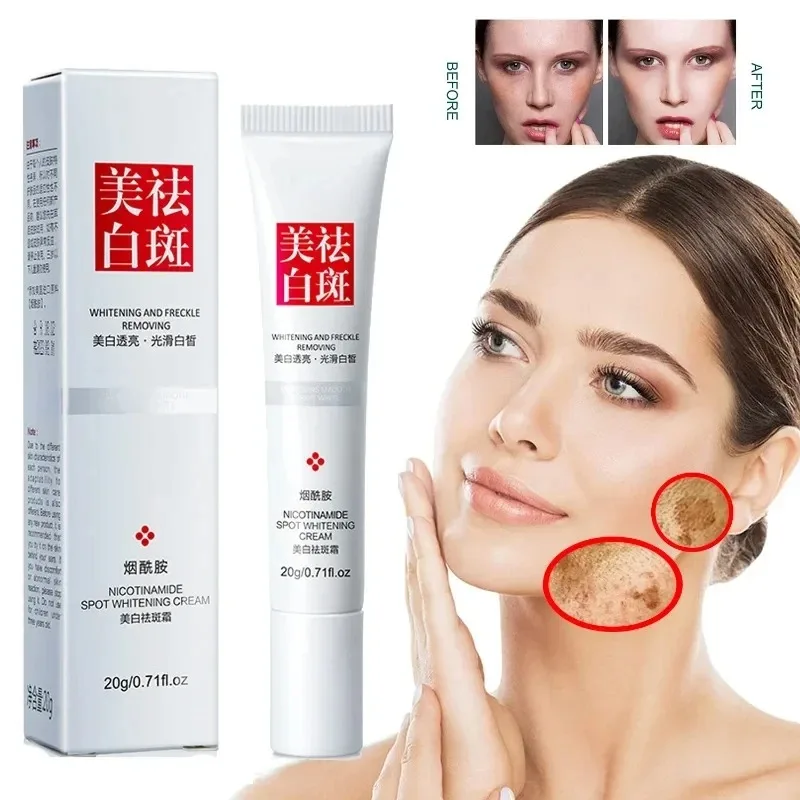 Fades Freckle Dark Spots Face  - огляд і ціна Skincare Niacinamide