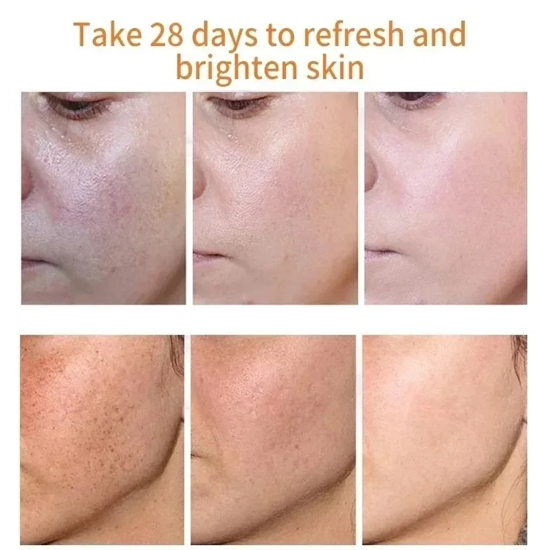 Fades Freckle Dark Spots Face  - огляд і ціна Skincare Niacinamide