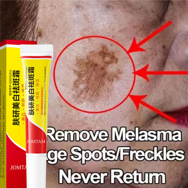 Whitening Freckle Cream Face B - огляд і ціна Skincare Niacinamide