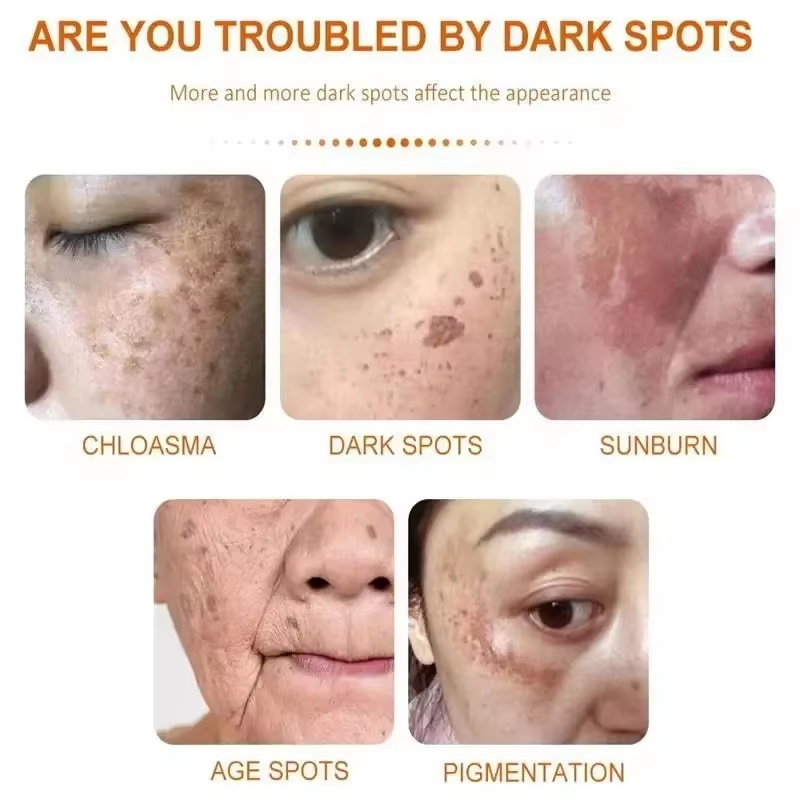 Whitening Freckle Cream Face B - огляд і ціна Skincare Niacinamide