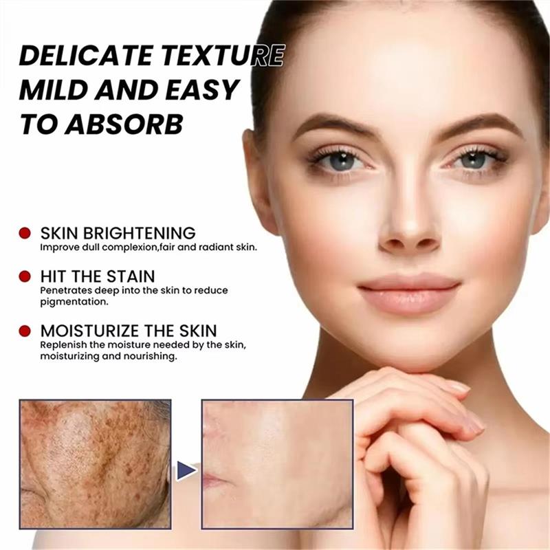 Whitening Freckle Cream Face B - огляд і ціна Skincare Niacinamide
